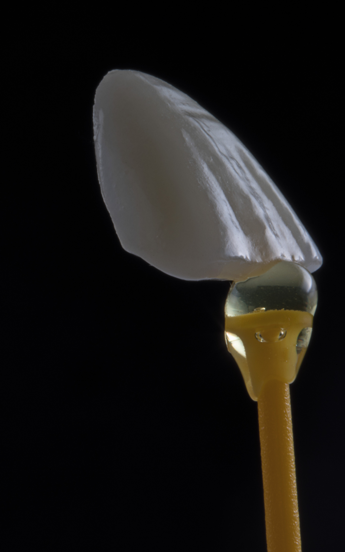 https://www.turquoisemedicalinternational.com/wp-content/uploads/2022/09/Porcelain-Veneers.png
